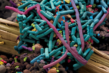 intestinal_bacteria